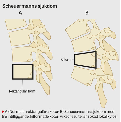 Smärta i nacke och rygg, del 2